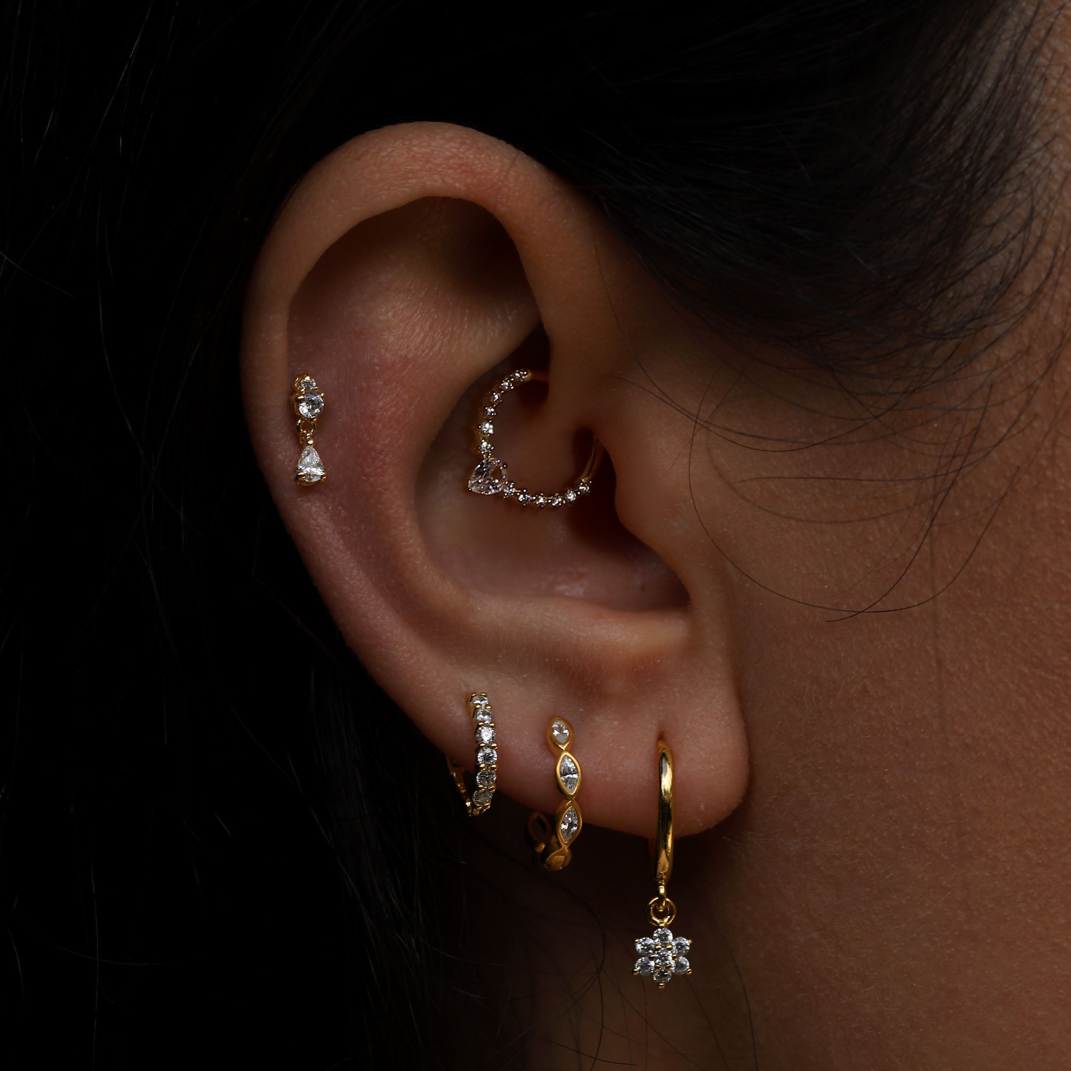 Daith as Migraine Cure